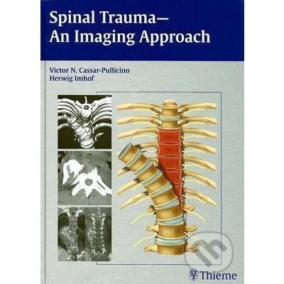 Spinal Trauma - Thieme – Hledejceny.cz