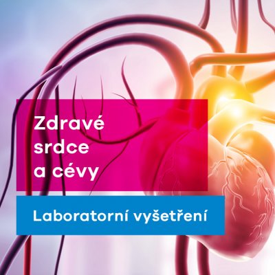 EUC Laboratoře test na zjištění rizika pro srdce a cévy – Hledejceny.cz