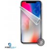 Ochranná fólie Screenshield Apple iPhone X/XS - displej