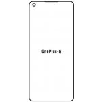 Ochranná fólie Hydrogel OnePlus 8 – Hledejceny.cz