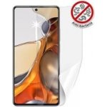 Ochranná fólie Screenshield XIAOMI 11T Pro - displej – Sleviste.cz