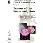 Tumors of the Bones and Joints – Sleviste.cz
