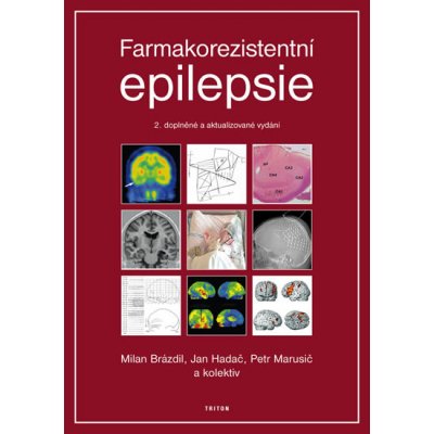 Farmakorezistentní epilepsie – Hledejceny.cz