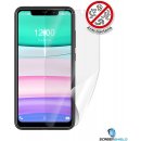 Ochranná fólie Screenshield OUKITEL C22