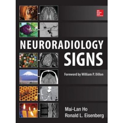 Neuroradiology Si - Ronald L. Eisenberg, Mai-Lan Ho