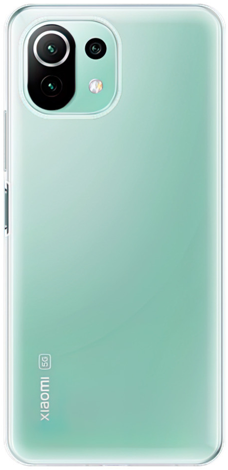 Pouzdro iSaprio s vlastním motivem Xiaomi Mi 11 Lite