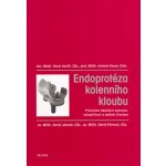 Endoprotéza kolenního kloubu -- Průvodce obdobím operace, rehabilitací a dalším životem. Pavel Vavřík, Antonín Sosna – Hledejceny.cz