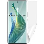 Ochranná fólie Screenshield HUAWEI Honor Magic 5 lite 5G - displej – Zboží Mobilmania