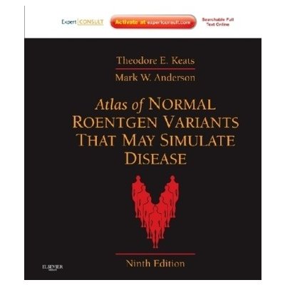 Atlas of Normal Roentgen Variants That May Simulate Disease Keats Theodore E.