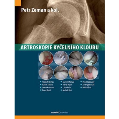 Artroskopie kyčelního kloubu - Petr Zeman a kolektiv – Zboží Mobilmania