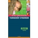Turnerův syndrom