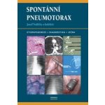 Spontánní pneumotorax, Etiopatogeneze, diagnostika, léčba – Hledejceny.cz