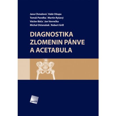 Diagnostika zlomenin pánve a acetabula - Martin Ryšavý, Jana Chmelová, Valér Džupa, Tomáš Pavelka – Hledejceny.cz