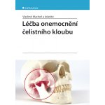 Léčba onemocnění čelistního kloubu - Machoň Vladimír, kolektiv – Hledejceny.cz
