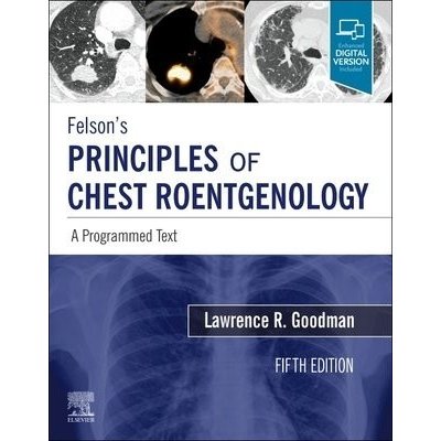 Felsons Principles of Chest Roentgenology, A Programmed Text