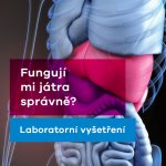 EUC Laboratoře test na funkčnost jater – Sleviste.cz