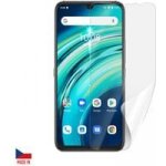 Ochranná fólie ScreenShield UMIDIGI A9 Pro - displej – Zbozi.Blesk.cz