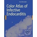 Color Atlas of Infective Endocarditis David R. Ramsdale – Hledejceny.cz