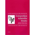 Endoprotéza kolenního kloubu -- Průvodce obdobím operace, rehabilitací a dalším životem. Pavel Vavřík, Antonín Sosna – Hledejceny.cz