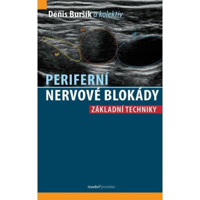 Periferní nervové blokády - Denis Buršík – Sleviste.cz