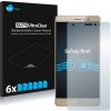 Ochranná fólie pro mobilní telefon 6x SU75 UltraClear Screen Protector Huawei Mate S