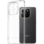 AlzaGuard Crystal Clear TPU Case pro Honor X7d AGD-PCT517Z – Hledejceny.cz
