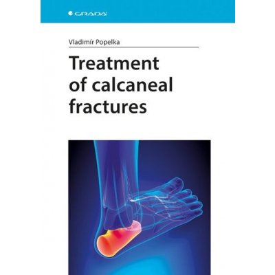 Treatment of calcaneal fractures - Vladimír Popelka