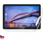 Screenshield IGET Smart L30 FullHD fólie na displej IGT-SML30FHD-D – Sleviste.cz