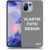 Pouzdro a kryt na mobilní telefon Xiaomi Pouzdro Picasee ULTIMATE CASE Xiaomi 11 Lite 5G NE - Vlastní design/motiv