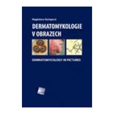 Dermatomykologie v obrazech - Magdalena Skořepová – Hledejceny.cz