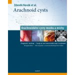 Colorectal Cancer Screening – Zboží Dáma