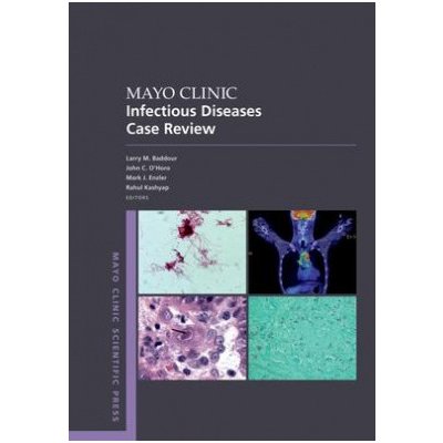 Mayo Clinic Infectious Disease Case Review : With Board Style Questions and Answers - Larry M Baddour John C O Horo Mark J Enzler Rahul Kashyap – Hledejceny.cz