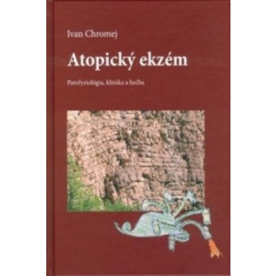 Atopický ekzém Ivan Chromej – Zbozi.Blesk.cz