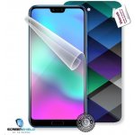 Ochranná fólie Screenshield Huawei Honor 10 - displej – Hledejceny.cz