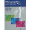 Kniha MR Imaging of the Abdomen and Pelvis