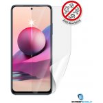 Ochranná fólie Screenshield XIAOMI Redmi Note 10S - displej – Hledejceny.cz