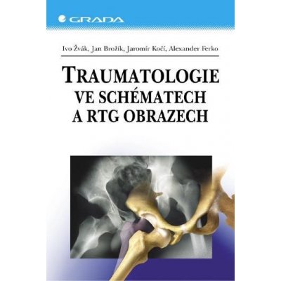 Ferko Alexander, Žvák Ivo, Brožík Jan, Kočí Jaromír - Traumatologie ve schématech a RTG obrazech