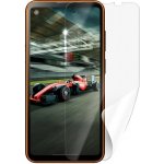 Ochranná fólie ScreenShield IGET Blackview GBL5000 - displej – Zbozi.Blesk.cz