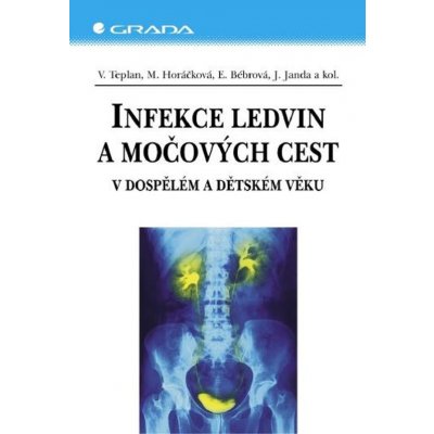 Infekce ledvin a močových cest – Zboží Mobilmania