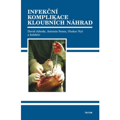 Infekční komplikace kloubních náhrad David Jahoda a kol. – Hledejceny.cz