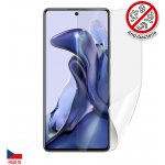 Ochranná fólie Screenshield XIAOMI 11T - displej – Sleviste.cz