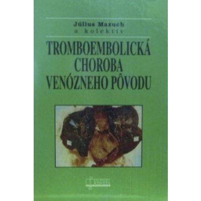 Tromboembolická choroba venózneho pôvodu – Hledejceny.cz