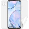 Ochranná fólie pro mobilní telefon Ochranné fólie Screenshield Huawei P40 Lite - celé tělo