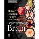 Diagnostic Imaging: Brain - Miral D. Jhaveri – Hledejceny.cz