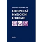 CHRONICKÁ MYELOIDNÍ LEUKEMIE – Hledejceny.cz