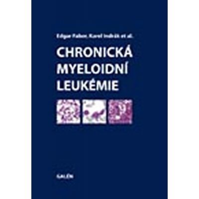 CHRONICKÁ MYELOIDNÍ LEUKEMIE