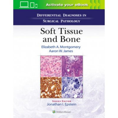 Differential Diagnoses in Surgical Pathology: Soft Tissue and Bone