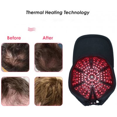 BM Cap kšiltovka na podporu růstu vlasů LED 660/850nm výkon 75W – Zboží Dáma