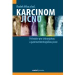 Karcinom jícnu - Průvodce pro chirurgickou a gastroenterologickou praxi - Vrba Radek – Hledejceny.cz