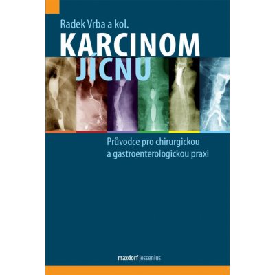 Karcinom jícnu - Průvodce pro chirurgickou a gastroenterologickou praxi - Vrba Radek – Zbozi.Blesk.cz
